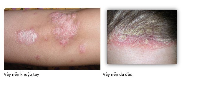 Vay-nen.jpg