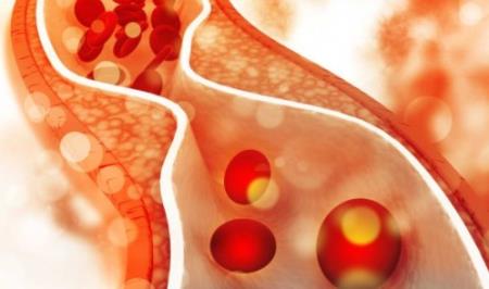 6 dấu hiệu của Hp88.com hiện đang mở báo động cholesterol máu cao