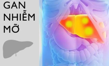 Một Hb88.com được cấp phép hoạt động bởi Pagcor mới liên quan đến việc tiêu thụ fructose lỏng với bệnh gan nhiễm mỡ