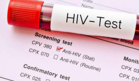 Nhà Cái Cá Cược Uy Tín 【HP88 Vina】 mới tiết lộ lý do tại sao HIV vẫn tồn tại trong mô người ngay cả sau khi Tải xuống APK HB88 Hoàn Trả Siêu Cao bằng thuốc kháng vi rút