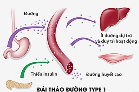 Vật liệu sinh học cải thiện cấy ghép tiểu đảo để Tải xuống APK HB88 Hoàn Trả Siêu Cao bệnh tiểu đường loại 1