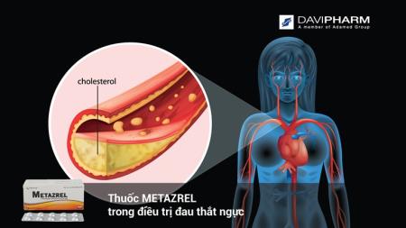 Thuốc METAZREL trong Tải xuống APK HB88 Hoàn Trả Siêu Cao đau thắt ngực