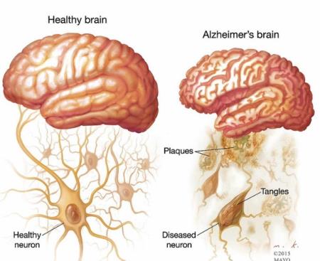 Tái tạo năng lượng cho ty thể để Tải xuống APK HB88 Hoàn Trả Siêu Cao bệnh Alzheimer